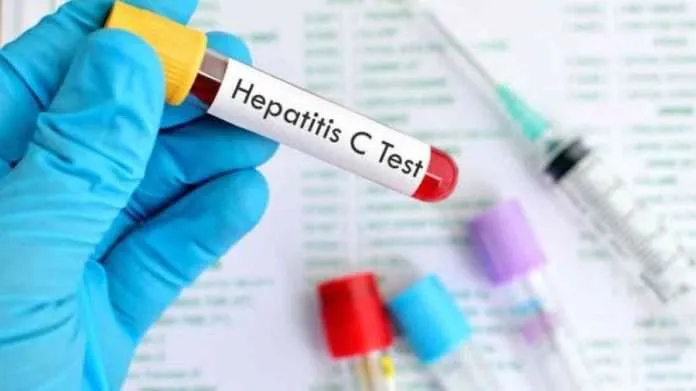 OMS precalifica test de diagnóstico de hepatitis C